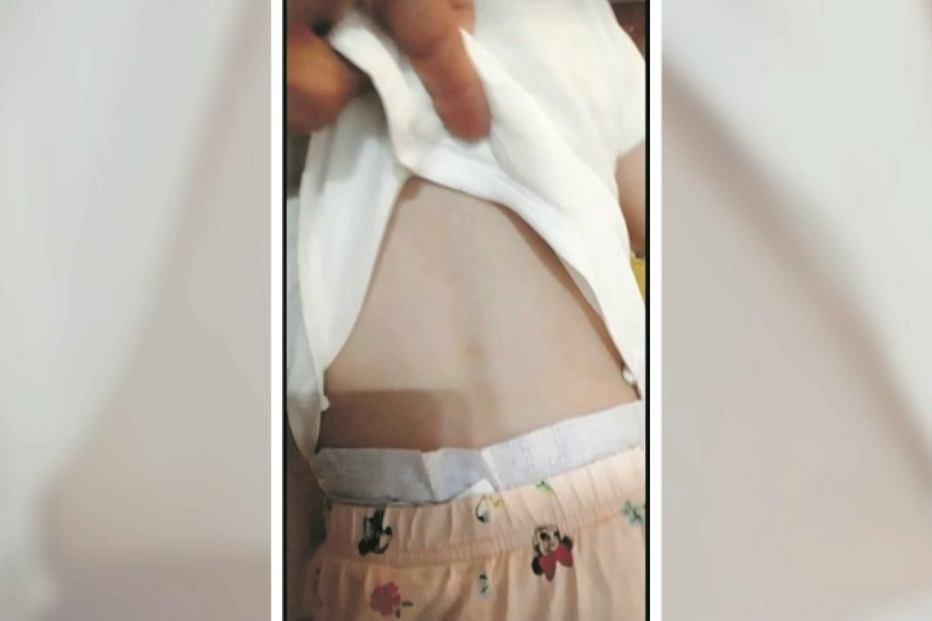 Pais de três crianças acusam funcionárias de creche em Gondomar de bater em bebés