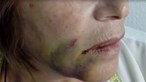 "Que mais ninguém sofra": Pacientes relatam tortura pelas mãos do dentista João Espírito Santo. Veja na CMTV