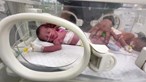 Equipa salva bebé com cesariana de emergência após ataque israelita em Gaza matar grávida de 30 semanas