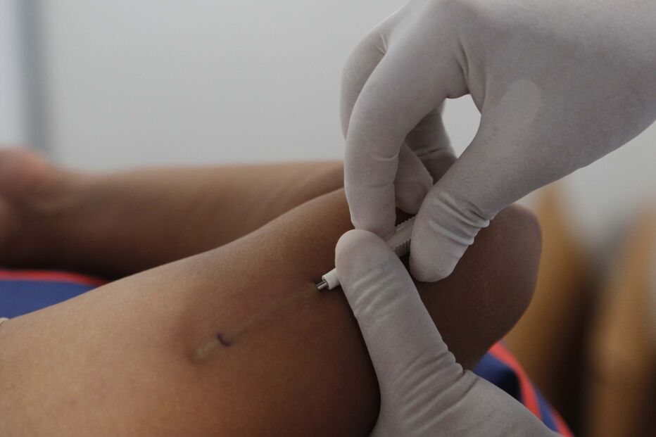 Implante contraceptivo