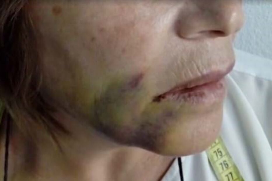 Pacientes de João Espírito Santo relatam danos irreversíveis