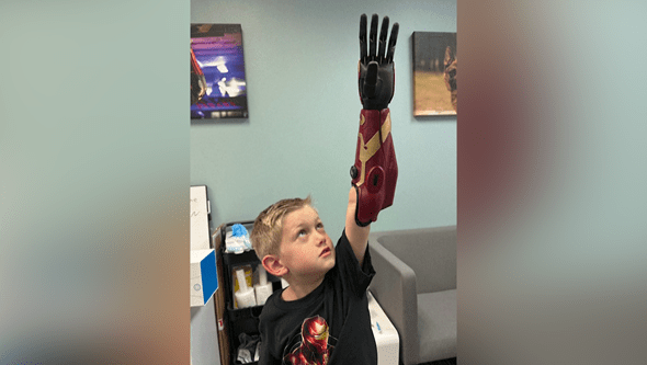 Menino de cinco anos torna-se o mais jovem do mundo a usar um “braço de super herói” biónico