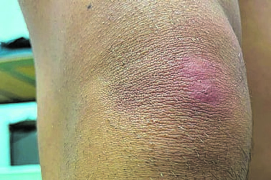 Caserna da GNR com surto de percevejos