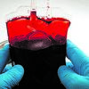 <![CDATA[ Faltam meios para recolher dádivas de sangue, aler
