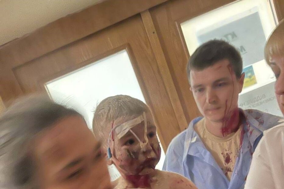 Ataque russo em Kiev com pelo menos cinco mortos atingiu hospital pediátrico