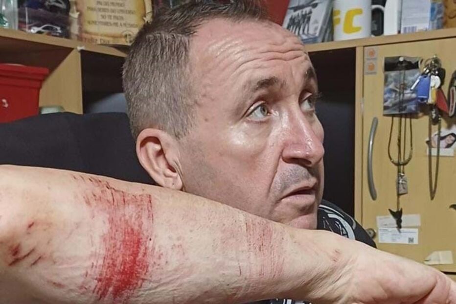 Pedro Santos ficou com arranhões nos braços e no peito	