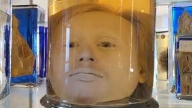 Cabeça do maior assassino português está há quase dois séculos num frasco de formol 