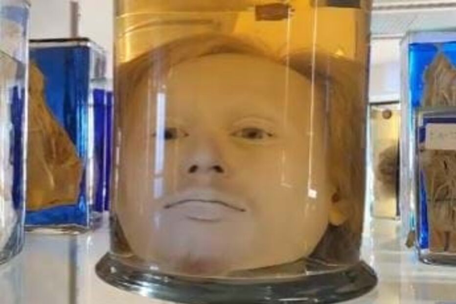 Cabeça do maior assassino português está há quase dois séculos num frasco de formol 