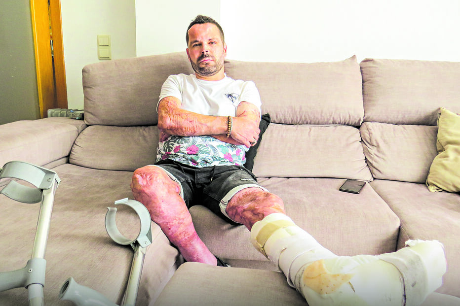 João Carraça foi o militar da GNR que sofreu mais queimaduras no corpo no incêndio de Mourão