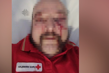 Cruz Vermelha repudia agressão a socorrista na Maia