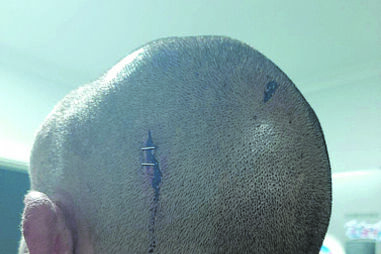 Homem espancado brutalmente ao sair de casa em Vila Nova de Santo André