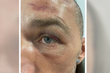 'HOMEM AGREDIDO VIZINHO PEÇA' 2