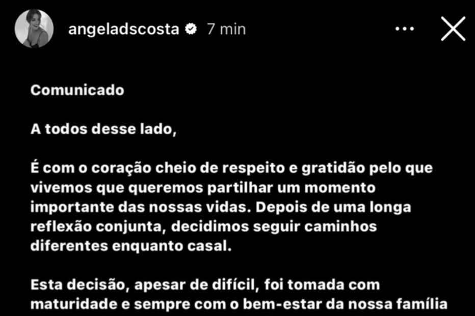 Angie Costa e Miguel Coimbra terminam relação 
