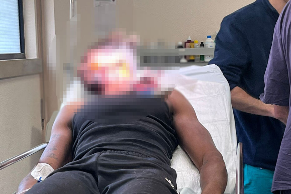 Arguido por sequestros esfaqueado na cara na cadeia do Montijo