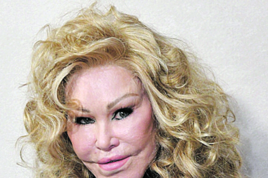 Jocelyn Wildenstein