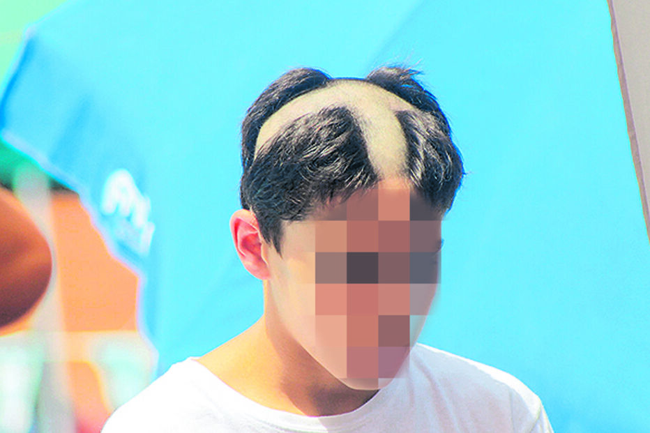 Praxe atira dirigentes de clube de natação e pais de menor para tribunal