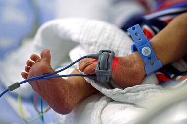 Nascimento de prematuros representa complexidade clínica
