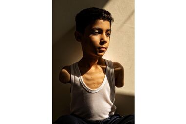 Fotografia do ano da World Press Photo de 2025 mostra menino palestiniano mutilado em Gaza