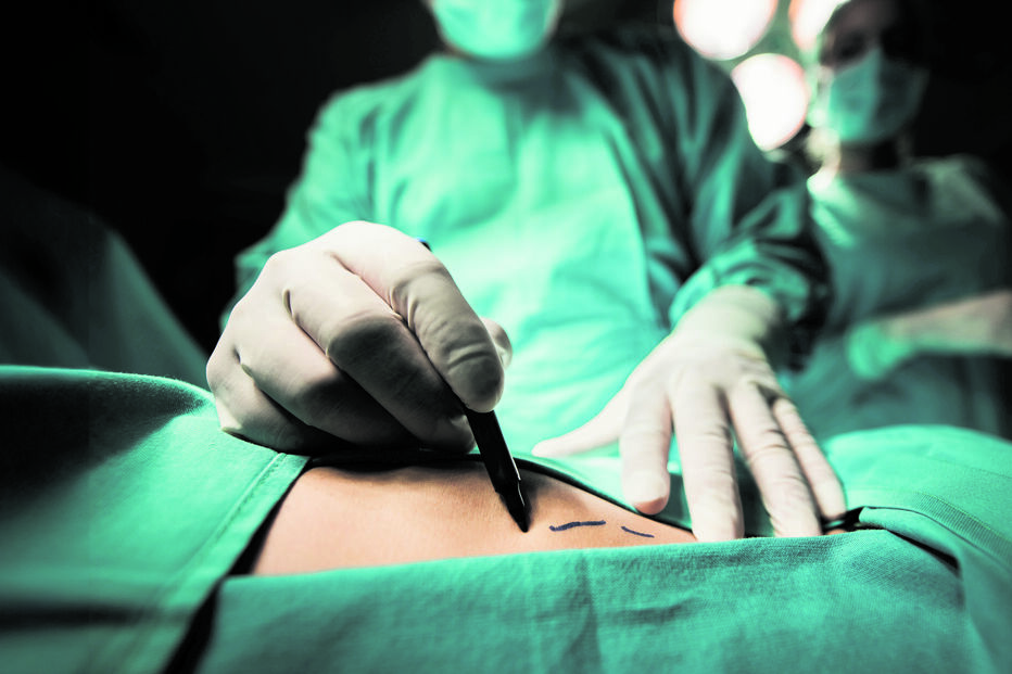 cirurgia XX ENFERMEIROS XXX MÉDICOS