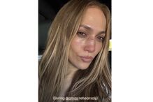 Jennifer Lopez mostra nariz magoado