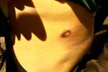 Adepto do Sporting mostra ferimentos na sequência de carga policial da festa do título