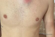 Adepto do Sporting mostra ferimentos na sequência de carga policial da festa do título