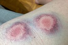 Adepto do Sporting mostra ferimentos na sequência de carga policial da festa do título