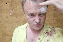 IMG-20250523-WA0011.jpg Arkady Bunin, dono de loja de canábis em Albufeira, agredido, sofreu ferimentos na cabeça