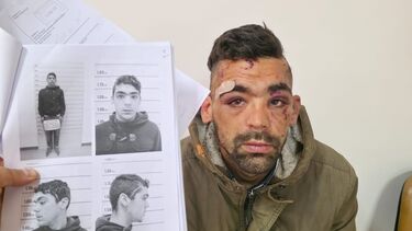 Jovem detido sem carta acusa PSP da Damaia de agressões  