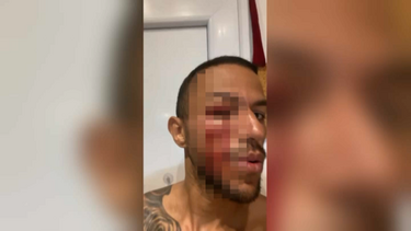 Os episódios de violência relatados por artistas que atuaram no circo Victor Hugo Cardinali