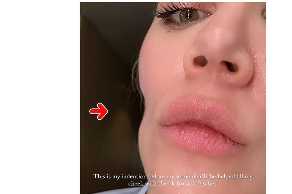 75621805-13958945-Khloe_shared_a_close_up_image_of_her_indention_and_revealed_that-m-50_172894091675.jpeg