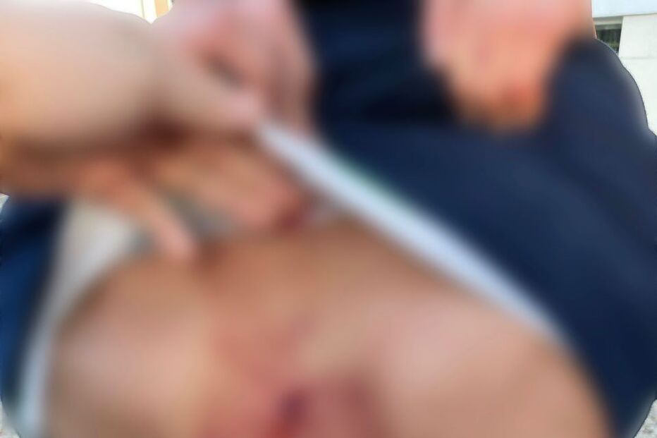 Jovem esfaqueado e outro apedrejado em ataque ao Núcleo do Sporting de Setúbal