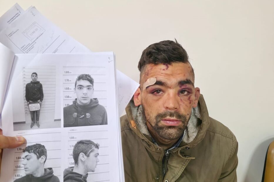 Jovem detido sem carta acusa PSP da Damaia de agressões  