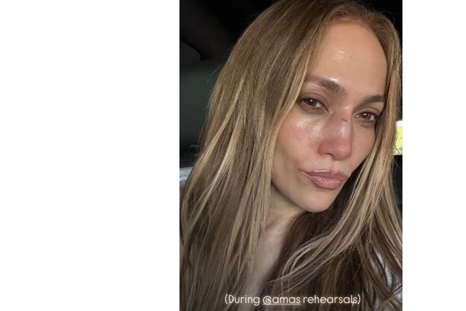 Jennifer Lopez mostra nariz magoado