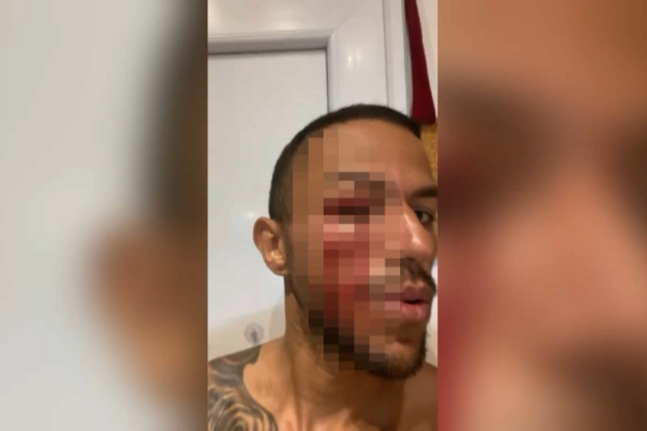 Os episódios de violência relatados por artistas que atuaram no circo Victor Hugo Cardinali