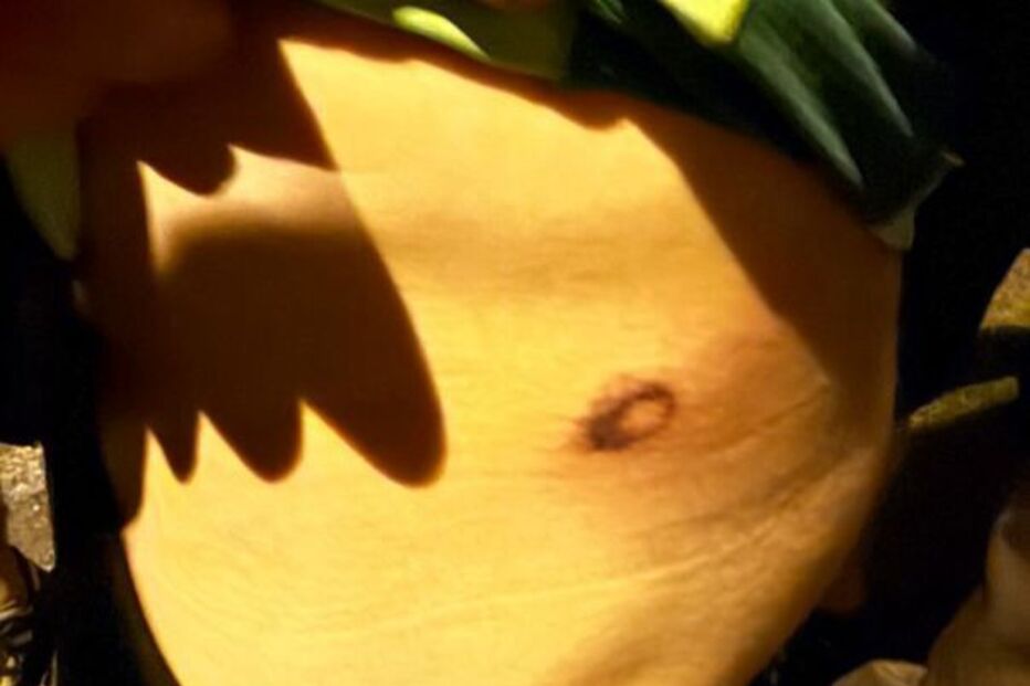 Adepto do Sporting mostra ferimentos na sequência de carga policial da festa do título