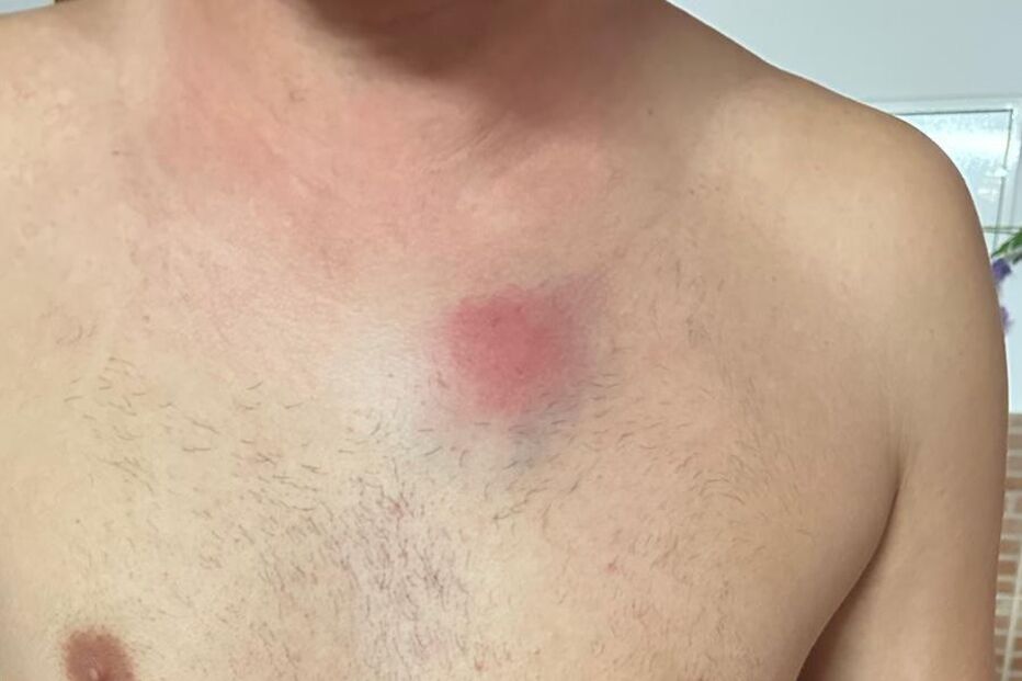 Adepto do Sporting mostra ferimentos na sequência de carga policial da festa do título