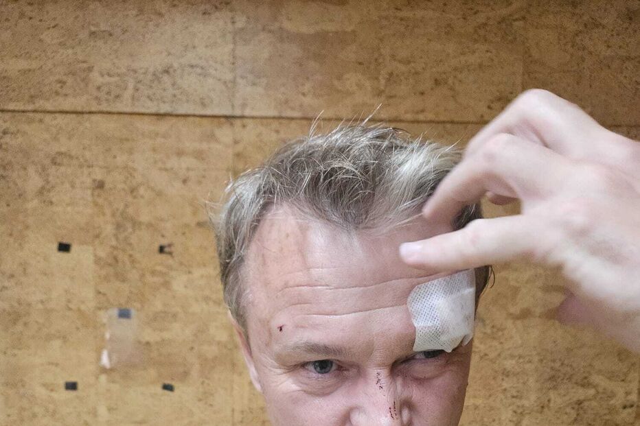 IMG-20250523-WA0011.jpg Arkady Bunin, dono de loja de canábis em Albufeira, agredido, sofreu ferimentos na cabeça