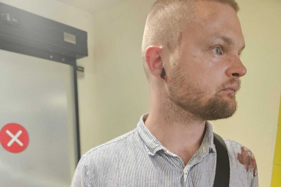 IMG-20250523-WA0022.jpg Gleb Bunin, filho do dono dew loja de canábis agredido juntamente com o pai