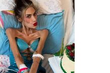 Nihal Candan, influenciadora turca, faleceu aos 30 anos devido a complicações da anorexia