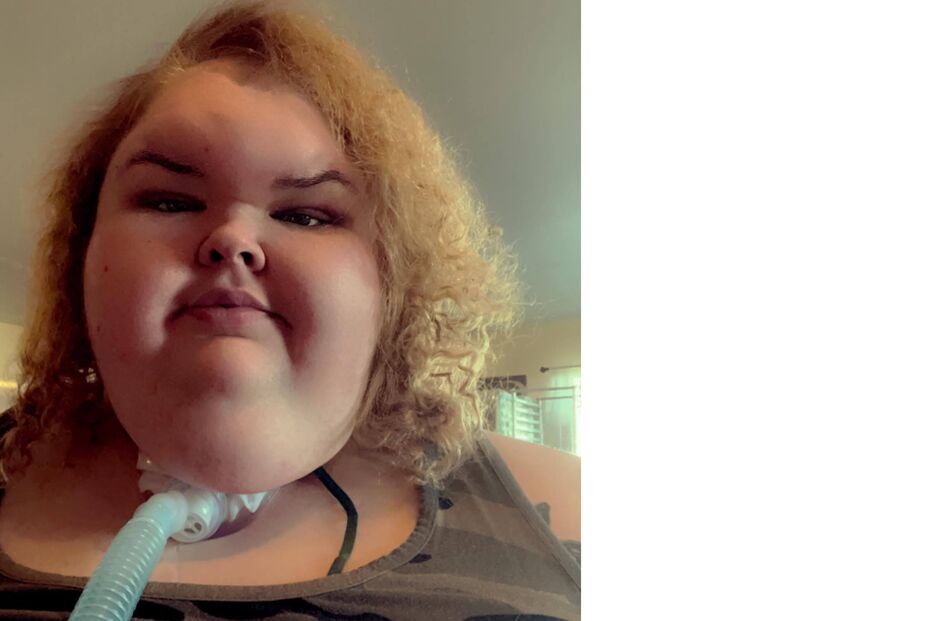 Tammy Slaton impressiona após perder 234 quilos e passar por nova cirurgia