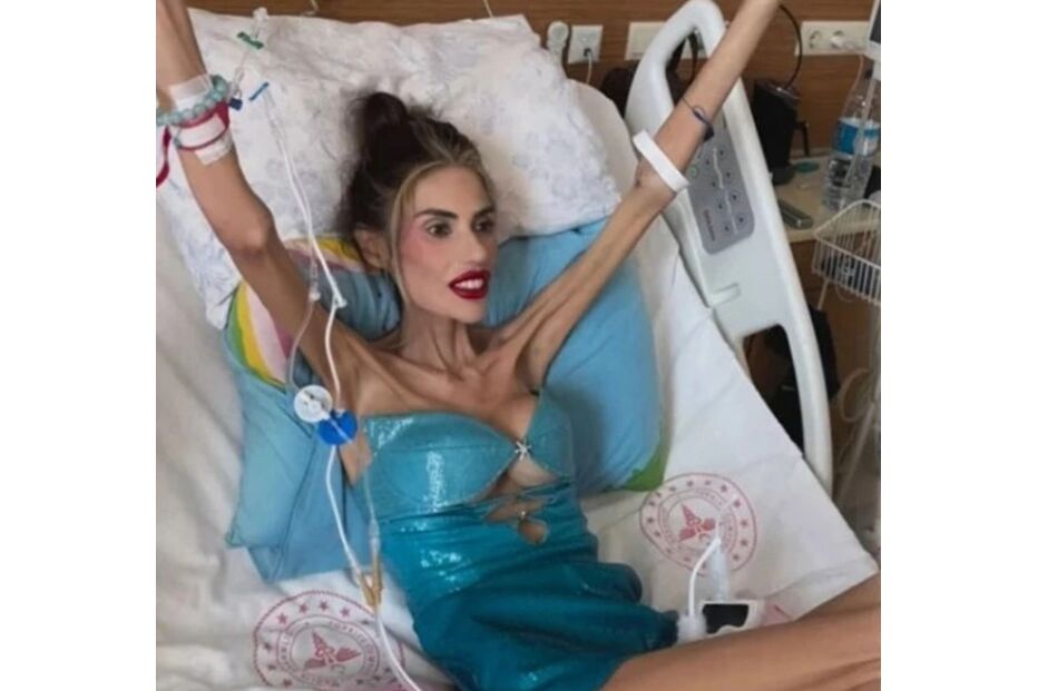 Influenciadora Nihal Candan morre aos 30 anos, vítima de anorexia na Turquia