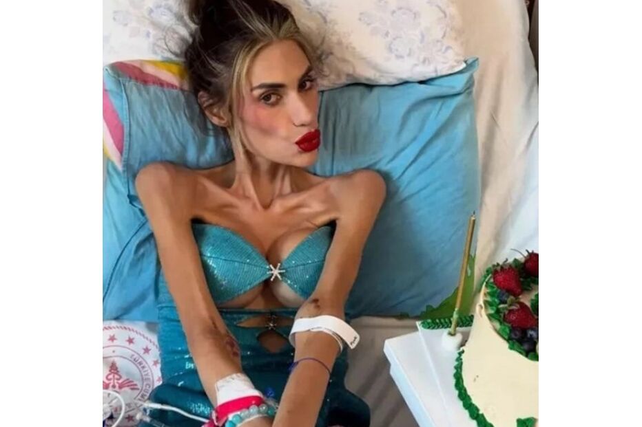 Nihal Candan, influenciadora turca, faleceu aos 30 anos devido a complicações da anorexia