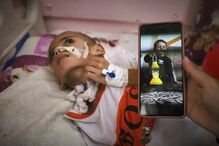 Em Gaza, Amr, vítima de ataque israelita, precisa de cuidados médicos urgentes