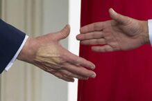 Trump diagnosticado com insuficiência venosa crónica após testes vasculares