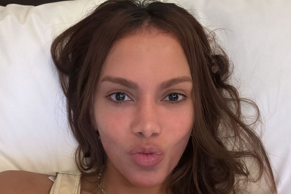 Anitta surge com novo rosto após período sem atividade nas redes sociais