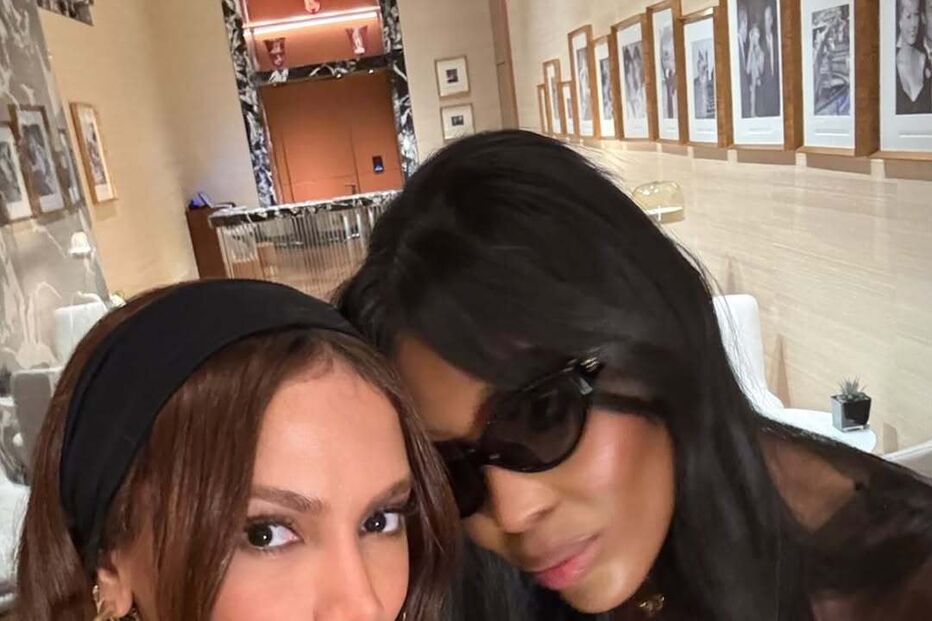 Anitta surge com rosto diferente após ausência nas redes sociais