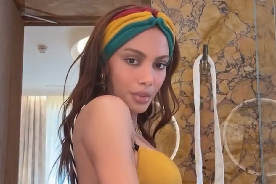 Anitta surge com rosto diferente após período afastada das redes sociais