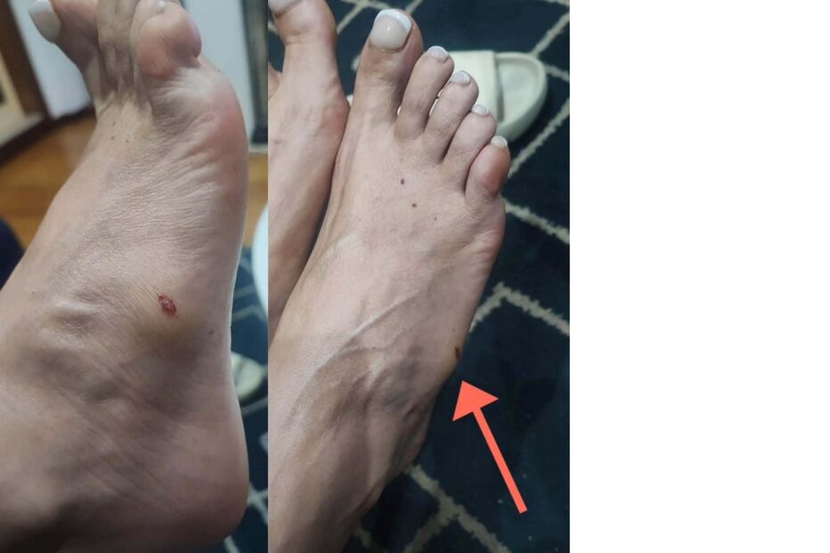 Maria Leal torce o pé à saída do cabeleireiro