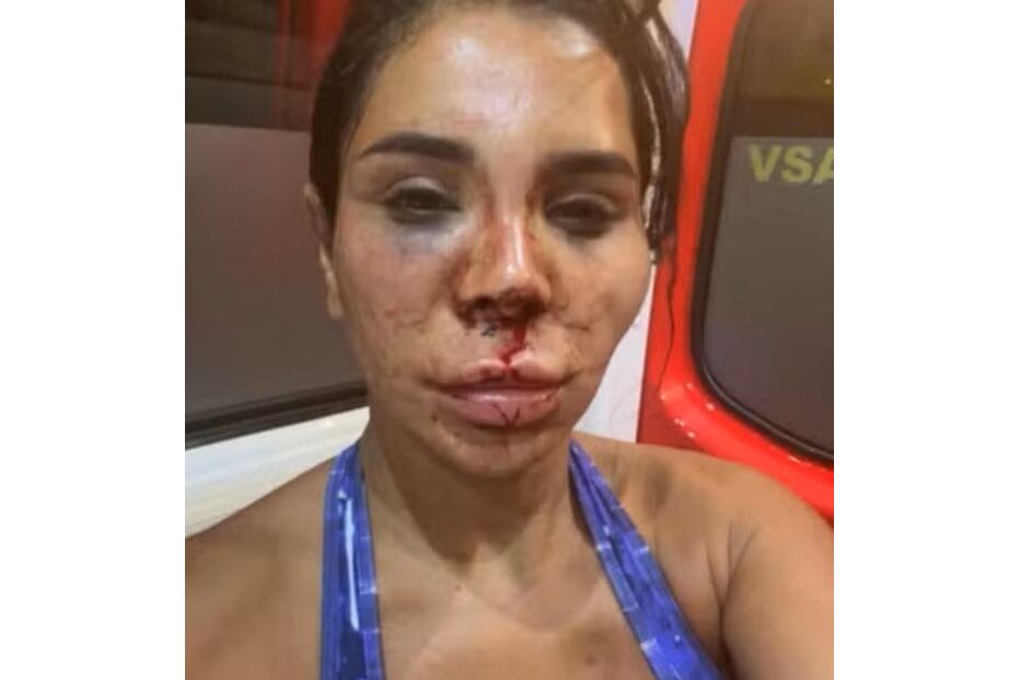 Mulher com ferimentos faciais visíveis, incluindo hematomas e cortes
